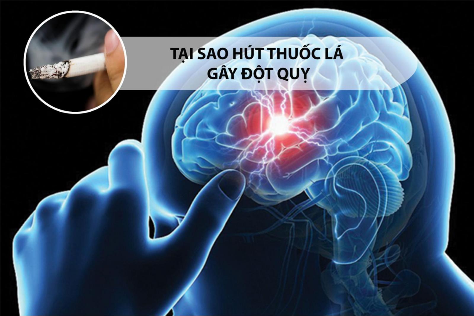 Tại sao hút thuốc lá gây đột quỵ?